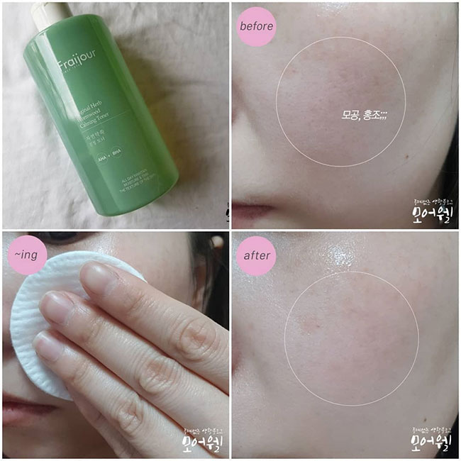 Review toner Fraijour có tốt không? Đánh giá mới nhất 2022 3 toner fraijour