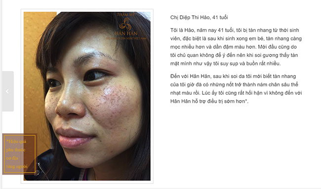 Top 10 spa trị nám tận gốc bằng công nghệ hiện đại bậc nhất tại Hà Nội 7 spa trị nám