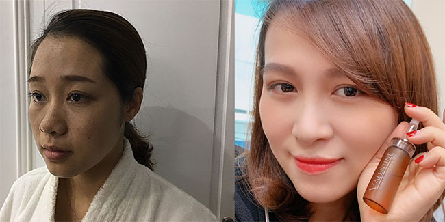 Review serum dưỡng trắng da Valentine – tinh hoa của của giải thưởng Nobel 5 serum dưỡng trắng da valentine