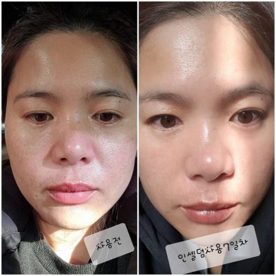 Bộ dưỡng da Incellderm “tái sinh làm da” có như lời đồn? 8 Bộ dưỡng da Incellderm