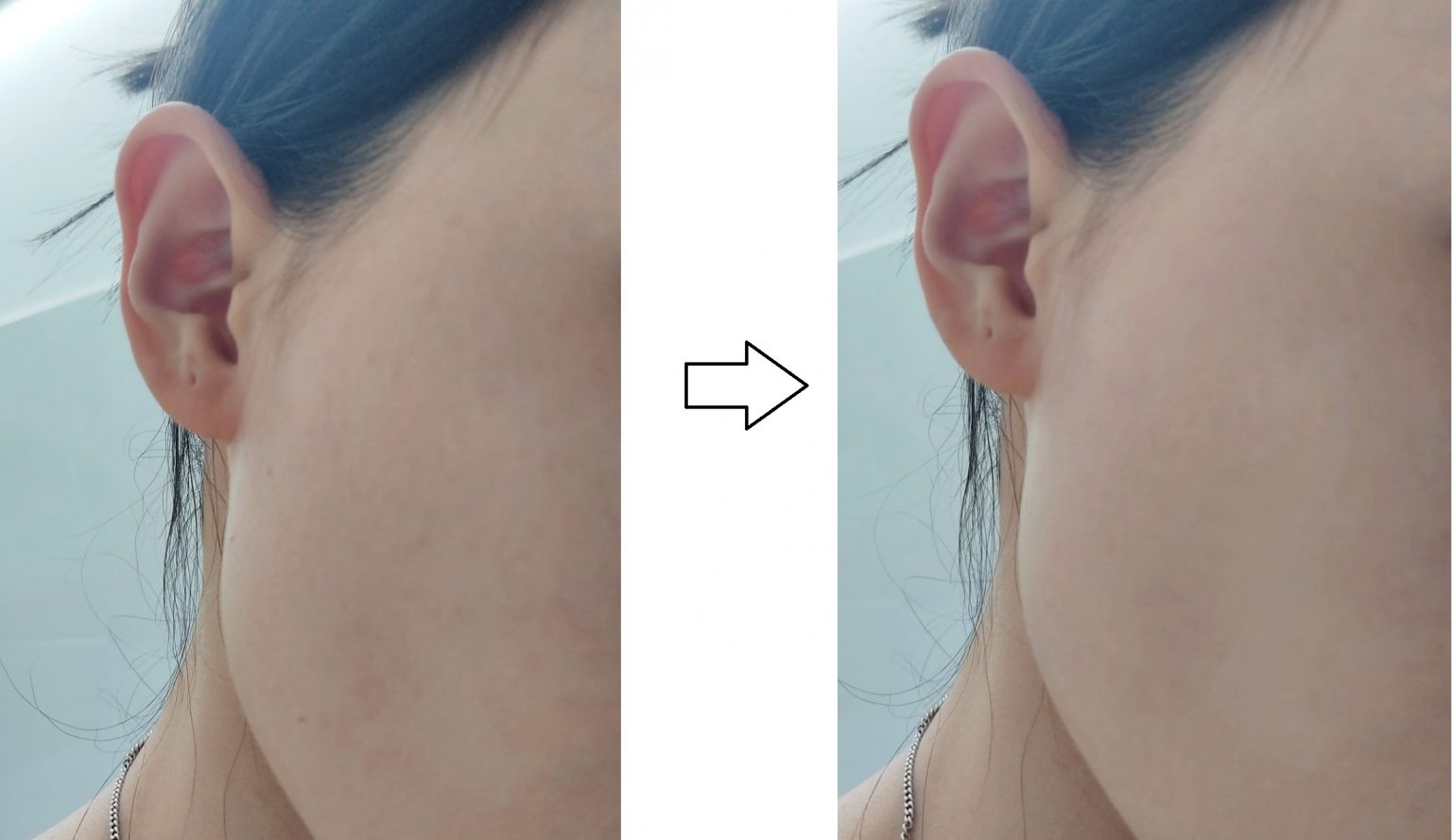 Thương hiệu Emmié by Happy Skin và dòng sữa rửa mặt emmie 17 Thương hiệu Emmié by Happy Skin và dòng sữa rửa mặt emmie